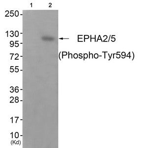 Western blot analysis of extracts from JK cells (Lane 2), using EPHA2/5 (Phospho-Tyr594) Antibody. The lane on the left is treated with antigen-specific peptide.