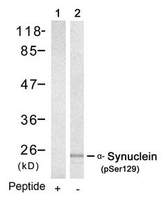 Western blot analysis of extracts from mouse brain tissue using a-Synuclein(Phospho-Ser129) Antibody(Lane 2) and the same antibody preincubated with blocking peptide(Lane1).