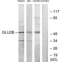 Western blot analysis of extracts from HepG2, 293 and HUVEC cells, using GLU2B antibody.