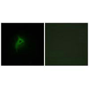 Immunofluorescence analysis of HepG2 cells, using Adrenergic Receptor alpha-2B antibody.