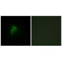 Immunofluorescence analysis of HepG2 cells, using Adrenergic Receptor alpha-2B antibody.