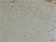 Immunohistochemical analysis of paraffin-embedded Mouse BrainTissue using KChIP1 Rabbit pAb diluted at 1:200.