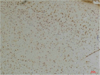 Immunohistochemical analysis of paraffin-embedded Mouse BrainTissue using KChIP1 Rabbit pAb diluted at 1:200.