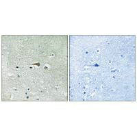 Immunohistochemistry analysis of paraffin-embedded human brain tissue using TTK (Ab-676) antibody.