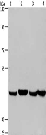 Gel: 6%SDS-PAGE, Lysate: 40 ug, Lane 1-4: A549 cells, Hela cells, PC3 cells, HepG2 cells, Primary antibody: CSB-PA586044(RBMY1A1 Antibody) at dilution 1/350, Secondary antibody: Goat anti rabbit IgG at 1/8000 dilution, Exposure time: 30 seconds