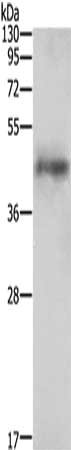 Gel: 10%SDS-PAGE, Lysate: 40 ug, Lane: 231 cells, Primary antibody: CSB-PA586539(AGTR1 Antibody) at dilution 1/250, Secondary antibody: Goat anti rabbit IgG at 1/8000 dilution, Exposure time: 30 seconds