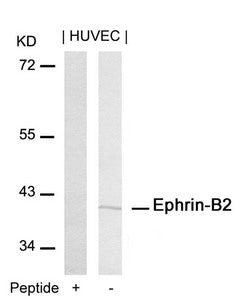 Western blot analysis of extracts from HUVEC cells using Ephrin-B2(Ab-316) Antibody and the same antibody preincubated with blocking peptide.