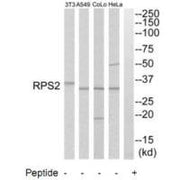 Western blot analysis of extracts from HeLa cells, A549 cells, COLO205 cells and NIH-3T3 cells, using RPS2 antibody.