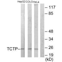 Western blot analysis of extracts from HepG2 cells, COLO205 cells and HeLa cells, using TCTP antibody.