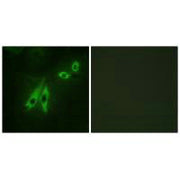 Immunofluorescence analysis of NIH/3T3 cells, using AKAP3 antibody.