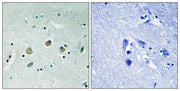 Immunohistochemical analysis of paraffin-embedded human brain tissue using MAP3K8 (Phospho-Ser400) antibody (left)or the same antibody preincubated with blocking peptide (right).