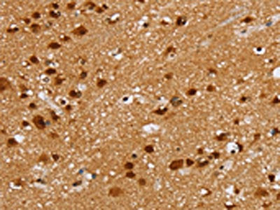 The image on the left is immunohistochemistry of paraffin-embedded Human brain tissue using CSB-PA588963(ZMAT3 Antibody) at dilution 1/30, on the right is treated with fusion protein. (Original magnification: ×200)