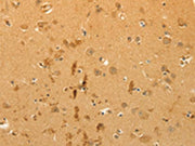 The image on the left is immunohistochemistry of paraffin-embedded Human brain tissue using CSB-PA589025(CFHR1 Antibody) at dilution 1/40, on the right is treated with fusion protein. (Original magnification: ×200)