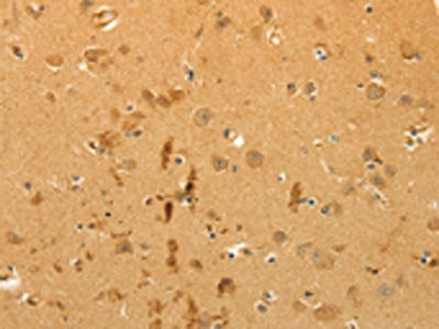 The image on the left is immunohistochemistry of paraffin-embedded Human brain tissue using CSB-PA589025(CFHR1 Antibody) at dilution 1/40, on the right is treated with fusion protein. (Original magnification: ×200)
