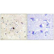 Immunohistochemical analysis of paraffin-embedded human brain tissue using GR (Ab-226) antibody.