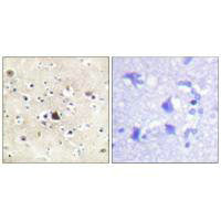 Immunohistochemical analysis of paraffin-embedded human brain tissue using GR (Ab-226) antibody.