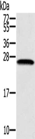 Gel: 12%SDS-PAGE, Lysate: 40 ug, Lane: K562 cells, Primary antibody: CSB-PA589520(SSX1 Antibody) at dilution 1/400, Secondary antibody: Goat anti rabbit IgG at 1/8000 dilution, Exposure time: 1 minute