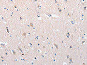 The image on the left is immunohistochemistry of paraffin-embedded Human brain tissue using CSB-PA589658(YWHAG Antibody) at dilution 1/100, on the right is treated with synthetic peptide. (Original magnification: ×200)