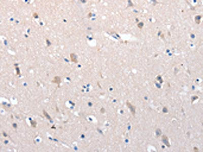 The image on the left is immunohistochemistry of paraffin-embedded Human brain tissue using CSB-PA589658(YWHAG Antibody) at dilution 1/100, on the right is treated with synthetic peptide. (Original magnification: ×200)