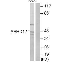 Western blot analysis of extracts from COLO cells, using ABHD12 antibody.