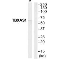 Western blot analysis of extracts from Jurkat cells, using THAS antibody.