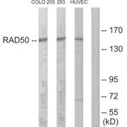 Western blot analysis of extracts from COLO205 cells, 293 cells and HUVEC cells, using RAD50 antibody.