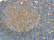 The image on the left is immunohistochemistry of paraffin-embedded Human tonsil tissue using CSB-PA589999(SNX3 Antibody) at dilution 1/30, on the right is treated with synthetic peptide. (Original magnification: ×200)