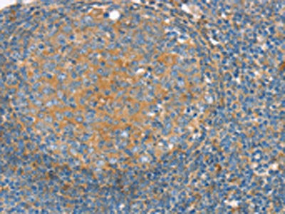 The image on the left is immunohistochemistry of paraffin-embedded Human tonsil tissue using CSB-PA589999(SNX3 Antibody) at dilution 1/30, on the right is treated with synthetic peptide. (Original magnification: ×200)