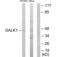 Western blot analysis of extracts from HUVEC cells and HeLa cells, using GALK1 antibody.