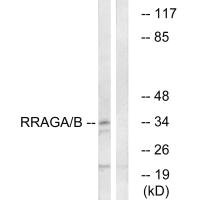 Western blot analysis of extracts from HepG2 cells, using RRAGA/B antibody.