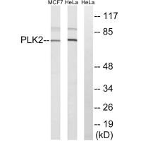 Western blot analysis of extracts from HeLa cells and MCF-7 cells, using PLK2 antibody.