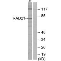Western blot analysis of extracts from Jurkat cells, using RAD21 antibody.