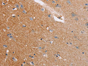 The image on the left is immunohistochemistry of paraffin-embedded Human brain tissue using CSB-PA590757(CASC3 Antibody) at dilution 1/20, on the right is treated with fusion protein. (Original magnification: ×200)