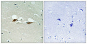 Immunohistochemical analysis of paraffin-embedded human brain tissue using ATF-2 (Phospho-Ser472) antibody (left)or the same antibody preincubated with blocking peptide (right).