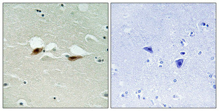 Immunohistochemical analysis of paraffin-embedded human brain tissue using ATF-2 (Phospho-Ser472) antibody (left)or the same antibody preincubated with blocking peptide (right).
