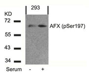 Western blot analysis of extracts from 293 cells untreated or treated with serum using AFX(Phospho-Ser197) Antibody.