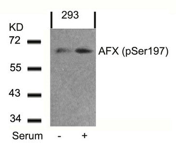Western blot analysis of extracts from 293 cells untreated or treated with serum using AFX(Phospho-Ser197) Antibody.