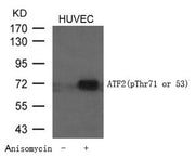 Western blot analysis of extracts from HUVEC cells untreated or treated with Anisomycin using ATF2 (Phospho-Thr71 or 53) Antibody.