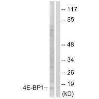 Western blot analysis of extracts from Jurkat cells, treated with Insulin (0.01U/ml, 15mins), using 4E-BP1 (Ab-64) antibody.