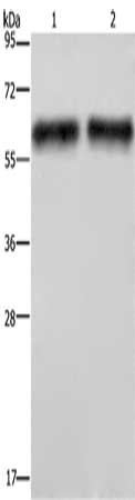 Gel: 10%SDS-PAGE, Lysate: 40 µg, 60 µg, Lane: Human hepatocellular carcinoma tissue, Primary antibody: CSB-PA591479(ELN Antibody) at dilution 1/400, Secondary antibody: Goat anti rabbit IgG at 1/8000 dilution, Exposure time: 2 minutes