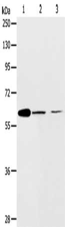 Gel: 10%SDS-PAGE, Lysate: 40 ug, Lane 1-3: NIH/3T3 cells, SKOV3 cells, human ovarian cancer tissue, Primary antibody: CSB-PA591967(ABCE1 Antibody) at dilution 1/450, Secondary antibody: Goat anti rabbit IgG at 1/8000 dilution, Exposure time: 2 min...