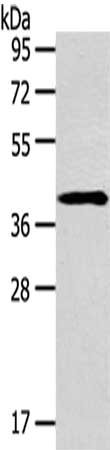 Gel: 8%SDS-PAGE,Lysate: 40 ug,,Primary antibody: CSB-PA592072(SERPINA3 Antibody) at dilution 1/200 dilution,Secondary antibody: Goat anti rabbit IgG at 1/8000 dilution,Exposure time: 2 minutes