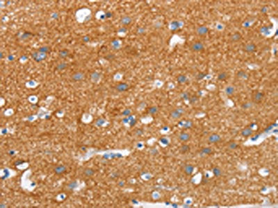 The image on the left is immunohistochemistry of paraffin-embedded Human brain tissue using CSB-PA592134(SNCA Antibody) at dilution 1/30, on the right is treated with synthetic peptide. (Original magnification: ×200)