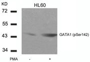 Western blot analysis of extracts from HL60 cells untreated or treated with PMA using GATA1(Phospho-Ser142) Antibody.