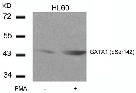 Western blot analysis of extracts from HL60 cells untreated or treated with PMA using GATA1(Phospho-Ser142) Antibody.