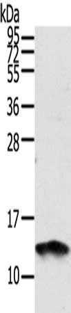 Gel: 12%SDS-PAGE, Lysate: 40 ug, Lane: PC3 cells, Primary antibody: CSB-PA592500(S100A11 Antibody) at dilution 1/1000, Secondary antibody: Goat anti rabbit IgG at 1/8000 dilution, Exposure time: 10 seconds