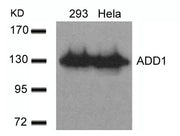 Western blot analysis of extracts from 293 and Hela cells using ADD1(Ab-726) Antibody.