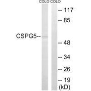 Western blot analysis of extracts from COLO cells, using CSPG5 antibody.