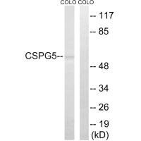 Western blot analysis of extracts from COLO cells, using CSPG5 antibody.