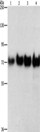 Gel: 8%SDS-PAGE, Lysate: 0.05-0.4 ug, Lane 1-4: 0.05 ug, 0.1 ug, 0.2 ug, 0.4 ug BSA, Primary antibody: CSB-PA592874(BSA Antibody) at dilution 1/1450, Secondary antibody: Goat anti rabbit IgG at 1/8000 dilution, Exposure time: 1 second